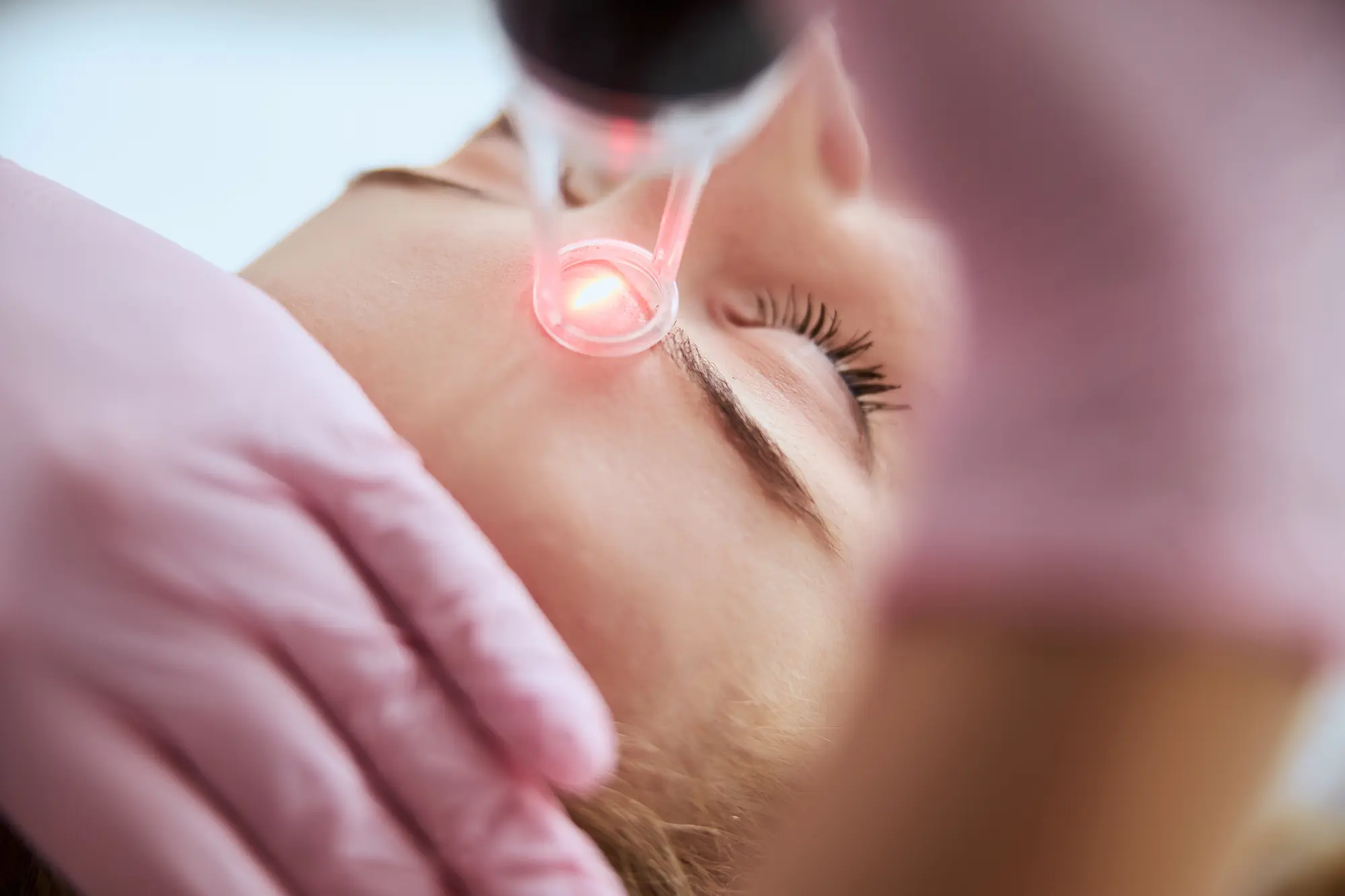 caucasian-female-getting-a-laser-skin-treatment-2025-03-06-23-59-30-utc (1)